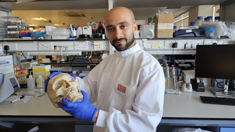 London Scientists Develop Wool-Based Material To Repair Damaged Bone